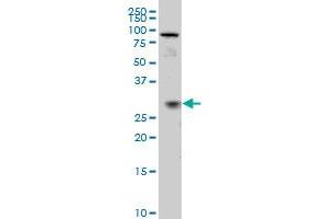 TGIF2 monoclonal antibody (M02), clone 5B11 Western Blot analysis of TGIF2 expression in IMR-32 . (TGIF2 anticorps  (AA 131-236))