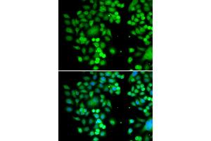 Immunofluorescence analysis of MCF-7 cells using PHYHD1 antibody (ABIN5974340).