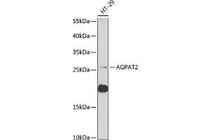 Western blot analysis of extracts of HT-29 cells, using  antibody (ABIN6129825, ABIN6136640, ABIN6136641 and ABIN6222174) at 1:1000 dilution. (AGPAT2 anticorps  (AA 199-278))