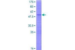 Image no. 1 for STT3, Subunit of The Oligosaccharyltransferase Complex, Homolog B (STT3B) (AA 1-225) protein (GST tag) (ABIN1321764)