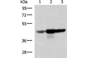 Western blot analysis of Human fetal brain tissue HepG2 and HT29 cell lysates using FDFT1 Polyclonal Antibody at dilution of 1:1000 (FDFT1 anticorps)