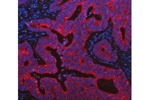 IF analysis of Cytokeratin 19 using anti-Cytokeratin 19 antibody (ABIN3043288).