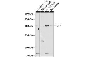 Western blot analysis of extracts of various cell lines, using UTY antibody (ABIN6132937, ABIN6150042, ABIN6150043 and ABIN6224660) at 1:1000 dilution. (UTY anticorps  (AA 1-70))