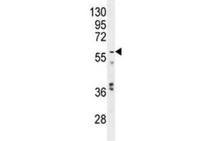 Glypican 3 antibody western blot analysis in mouse stomach tissue lysate