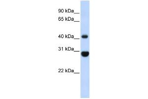 WB Suggested Anti-CNP Antibody Titration: 0. (Cnpase anticorps  (Middle Region))