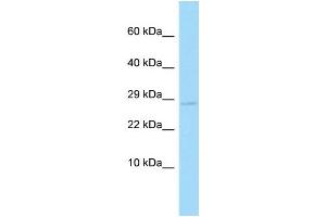 WB Suggested Anti-Cyb5d2 Antibody Titration: 0. (CYB5D2 anticorps  (C-Term))