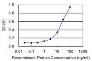 Detection limit for recombinant GST tagged SOX18 is 0.