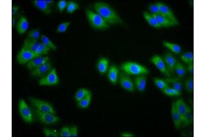 Immunofluorescence staining of HepG2 cells with ABIN7157546 at 1:133, counter-stained with DAPI. (KIRREL3 anticorps  (AA 200-343))