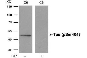 Western blot analysis of extracts from C6 cells, treated with calf intestinal phosphatase (CIP), using Tau (Phospho-Ser404) Antibody. (MAPT anticorps  (pSer404))
