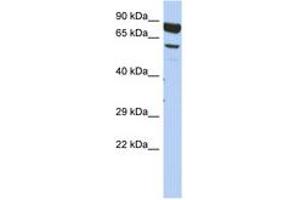 Image no. 1 for anti-Dpy-19-Like 4 (DPY19L4) (AA 575-624) antibody (ABIN6743891)