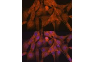 Immunofluorescence analysis of NIH-3T3 cells using K48-linkage Specific Ubiquitin Rabbit mAb (ABIN1680189, ABIN3017871, ABIN3017872 and ABIN7101530) at dilution of 1:100 (40x lens).