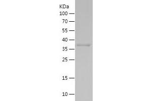 Western Blotting (WB) image for Microtubule-Associated Protein 1 Light Chain 3 alpha (MAP1LC3A) (AA 1-120) protein (His-IF2DI Tag) (ABIN7123957)