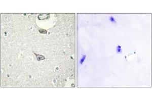 Immunohistochemistry analysis of paraffin-embedded human brain tissue, using CADM4 Antibody.