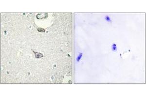 Immunohistochemistry analysis of paraffin-embedded human brain tissue, using CADM4 Antibody. (Cell Adhesion Molecule 4 anticorps  (AA 339-388))