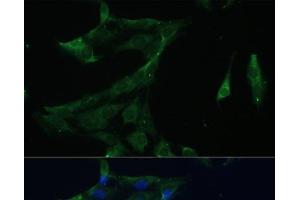 Immunofluorescence analysis of C6 cells using ARL3 Polyclonal Antibody at dilution of 1:100 (40x lens).