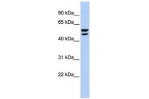 Image no. 1 for anti-ATPase, H+ Transporting, Lysosomal 56/58kDa, V1 Subunit B2 (ATP6V1B2) (AA 35-84) antibody (ABIN6744045) (ATP6V1B2 anticorps  (AA 35-84))
