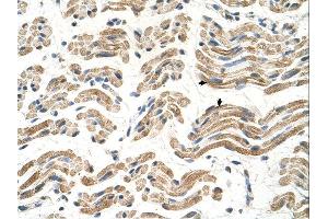 ALDH4A1 antibody was used for immunohistochemistry at a concentration of 4-8 ug/ml.