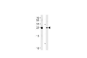 Western blot analysis in Daudi,K562 cell line lysates (35ug/lane). (MOBKL1A anticorps  (C-Term))