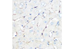 Immunohistochemistry of paraffin-embedded human liver using Caveolin-1 Rabbit pAb (ABIN6131271, ABIN6137992, ABIN6137993 and ABIN6218615) at dilution of 1:100 (40x lens).