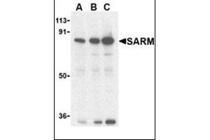 Western blot analysis of SARM in Daudi cell lysates with this product at (A) 0. (SARM1 anticorps  (C-Term))