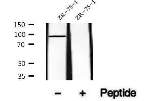 anti-Slingshot Homolog 3 (SSH3) (pSer37) antibody