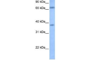 WB Suggested Anti-FEM1B Antibody Titration: 0. (FEM1B anticorps  (Middle Region))
