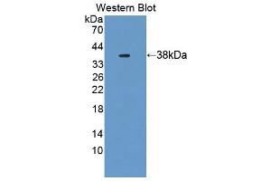 Western blot analysis of the recombinant protein. (UBAP1 anticorps  (AA 1-295))