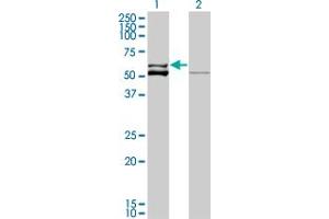 Western Blot analysis of GLUD2 expression in transfected 293T cell line by GLUD2 monoclonal antibody (M01A), clone 3C2. (GLUD2 anticorps  (AA 1-264))