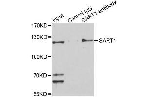 Immunoprecipitation analysis of 150ug extracts of Jurkat cells using 3ug SART1 antibody. (SART1 anticorps)