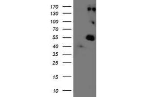 Western Blotting (WB) image for anti-Lysyl Oxidase (LOX) (AA 22-168) antibody (ABIN1491215) (LOX anticorps  (AA 22-168))