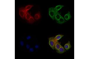 ABIN6262023 and ABIN6279475 staining Hela cells by IF/ICC.