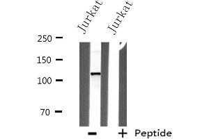 Western blot analysis of extracts from Jurkat cells, using ITPKB antibody. (ITPKB anticorps  (Internal Region))