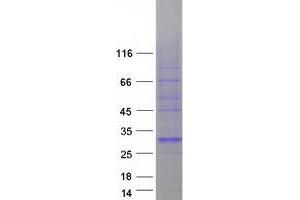 Validation with Western Blot