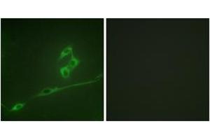 Immunofluorescence analysis of NIH-3T3 cells, using p70 S6 Kinase (Ab-371) Antibody. (RPS6KB1 anticorps  (AA 337-386))