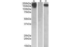 HEK293 lysate (10ug protein in RIPA buffer) overexpressing Human CSF1R with C-terminal MYC tag probed with ABIN2562031 (0. (CSF1R anticorps  (AA 700-710))