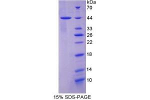 SDS-PAGE of Protein Standard from the Kit (Highly purified E. (Cytokeratin 7 Kit ELISA)