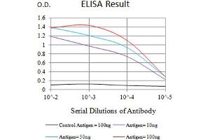 Black line: Control Antigen (100 ng),Purple line: Antigen (10 ng), Blue line: Antigen (50 ng), Red line:Antigen (100 ng)