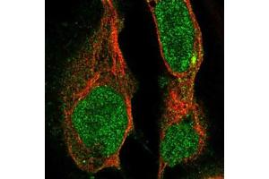 Immunofluorescent staining of U-2 OS cells with MAP3K13 polyclonal antibody  (Green) shows localization to nucleoplasm, cytosol and microtubule organizing center.