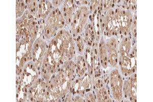 ABIN6267600 at 1/200 staining human kidney tissue sections by IHC-P.