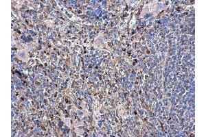 IHC-P Image beta Tubulin antibody detects beta Tubulin protein at cytoplasm in rat spleen by immunohistochemical analysis.