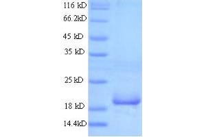 BETAT (AA 16-198) protein (His tag)