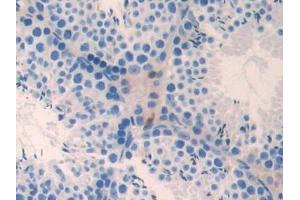 DAB staining on IHC-P; Samples: Mouse Testis Tissue