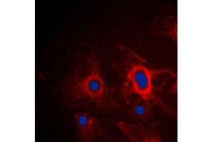Immunofluorescent analysis of iNOS staining in A549 cells. (NOS2 anticorps  (C-Term))