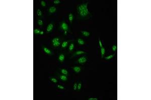 Immunofluorescence staining of HepG2 cells(treated with 50 mM Calyculin A for 30 min) with ABIN7127739 at 1:100,counter-stained with DAPI.