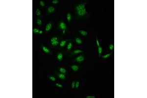 Immunofluorescence staining of HepG2 cells(treated with 50 mM Calyculin A for 30 min) with ABIN7127739 at 1:100,counter-stained with DAPI. (Recombinant RAF1 anticorps  (pSer621))