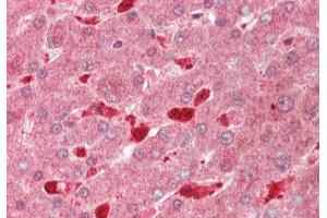 anti-Profilin 1 (PFN1) (N-Term) antibody