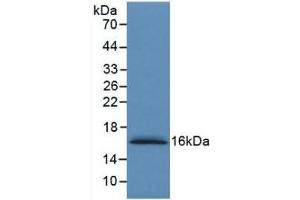 Detection of Recombinant S100A6, Human using Monoclonal Antibody to S100 Calcium Binding Protein A6 (S100A6)