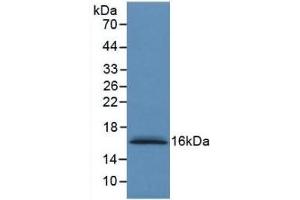 Detection of Recombinant S100A6, Human using Monoclonal Antibody to S100 Calcium Binding Protein A6 (S100A6) (S100A6 anticorps  (AA 1-90))