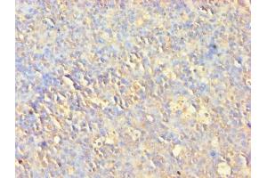 Immunohistochemistry of paraffin-embedded human tonsil tissue using ABIN7167024 at dilution of 1:100 (AKT1 anticorps  (AA 1-480))