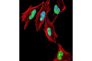 Fluorescent confocal image of  cell stained with TBX1 Antibody (C-term) (ABIN653331 and ABIN2842819). (T-Box 1 anticorps  (C-Term))